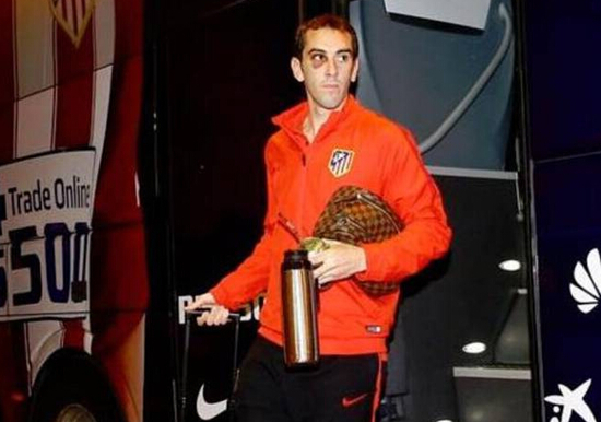 苏牙这肘真狠马竞队副仍黑眼